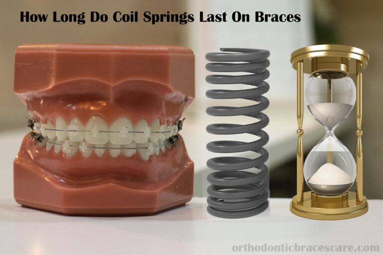 How Long Do Coil Springs Last